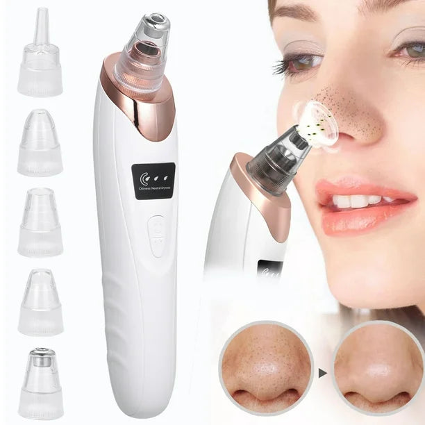 FaceClean® Succionador Facial de Espinillas